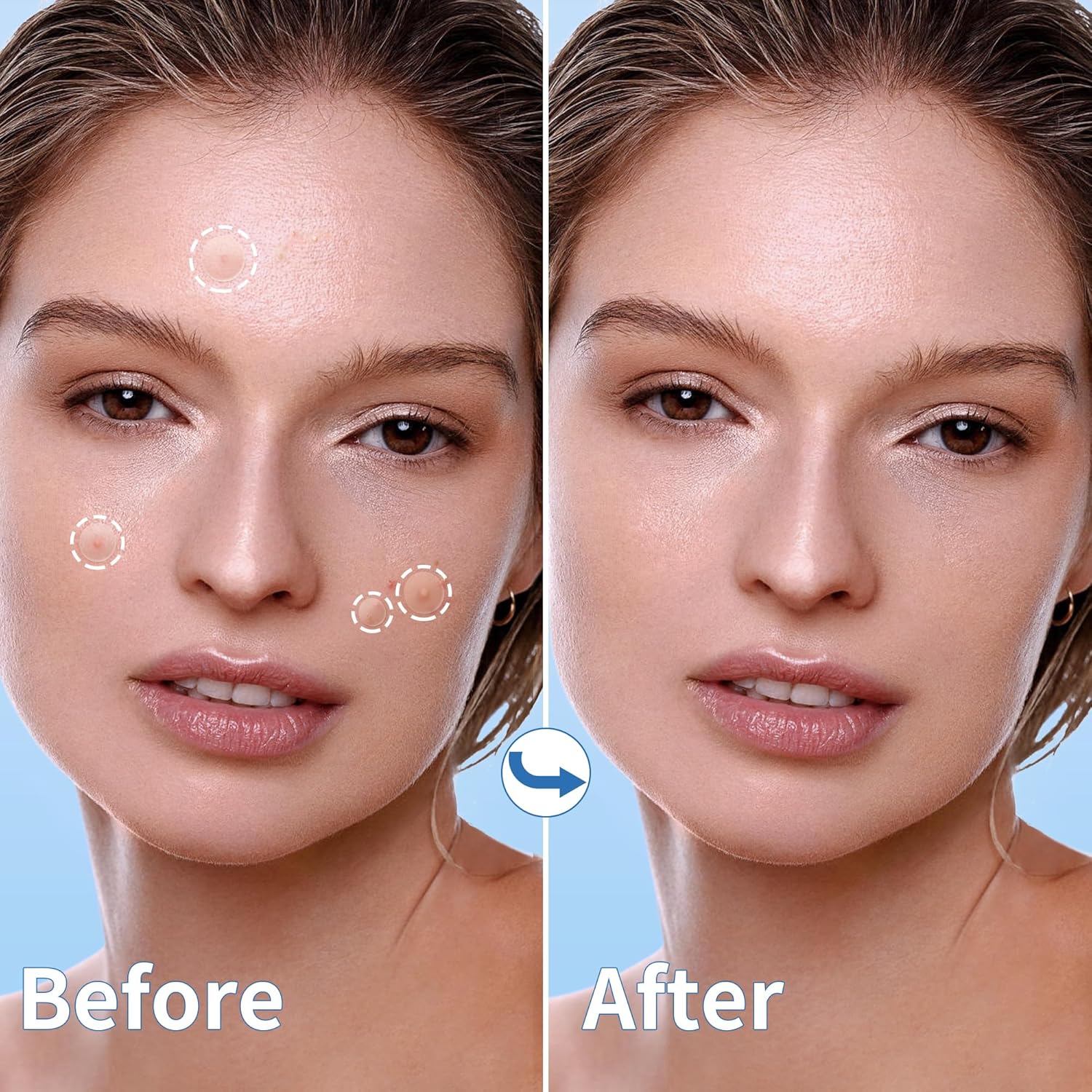 Pimple Patch Company Values